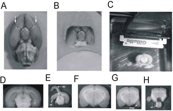 figure-protocol-2 Mouse brain dissection process; anatomical section preparation, tissue slicing setup, brain regions.