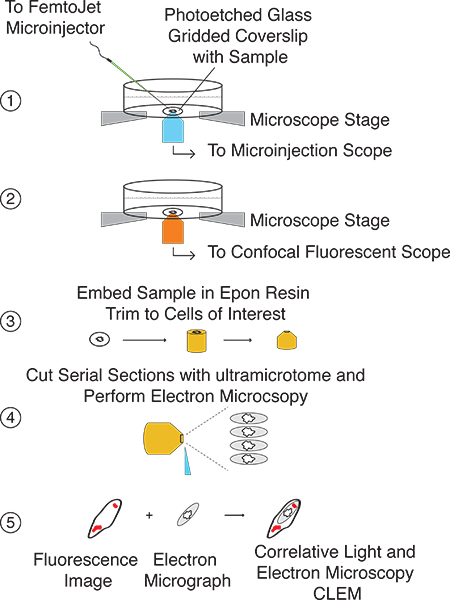 figure-protocol-2 Microscopy workflow diagram: microinjection, confocal, electron microscopy, sample processing.