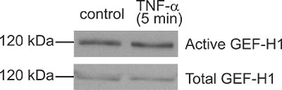 Western blot analysis of GEF-H1 activation under TNF-α stimulation; protein bands at 120 kDa.