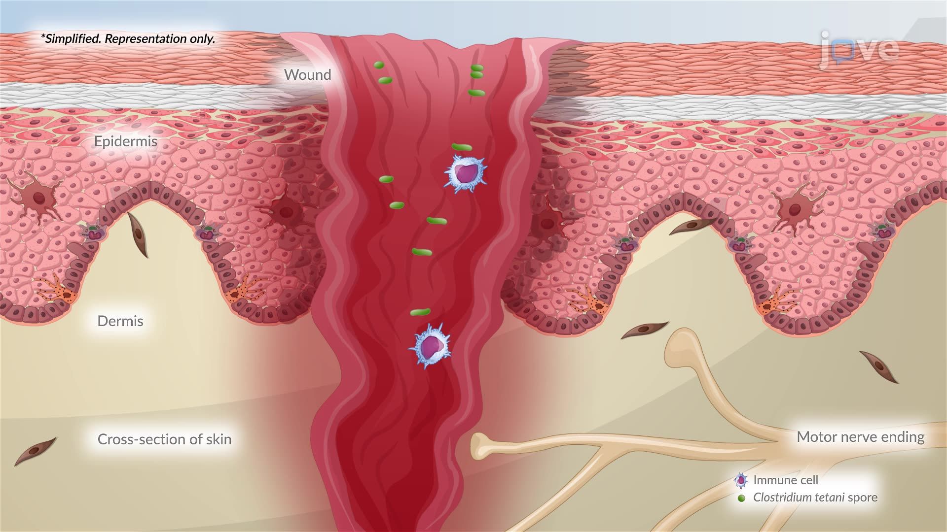 Tetanus Cell Diagram