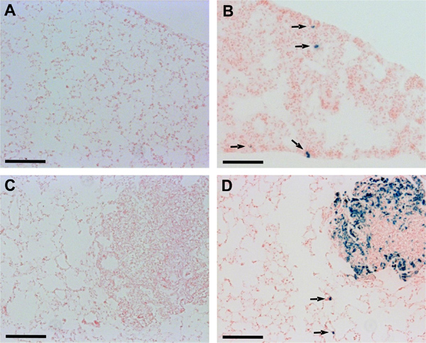 figure-protocol-2 Histological analysis of lung tissue. Diagrams show cell distribution and staining results.