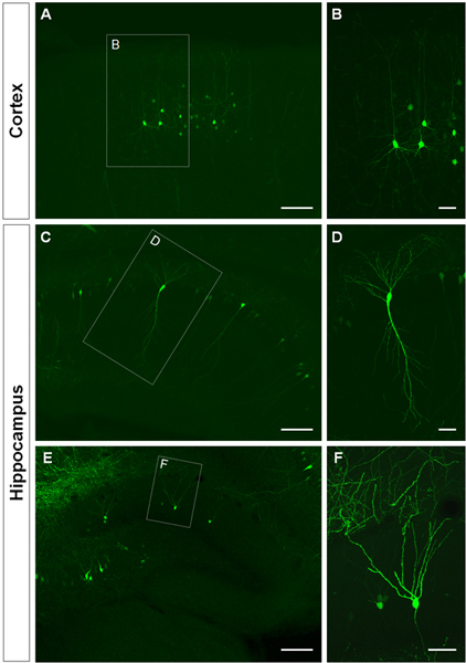 figure-protocol-3 Cortex and hippocampus neuron fluorescence; microscope image; neuron morphology; neural networks.