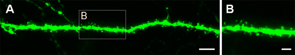 figure-protocol-4 Fluorescent microscopy image of neuronal dendrite showing synaptic structures and dendritic spines.