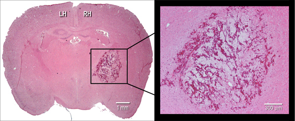figure-protocol-2 Histological brain section, magnified inset, showcasing tissue morphology for neuroscience study.