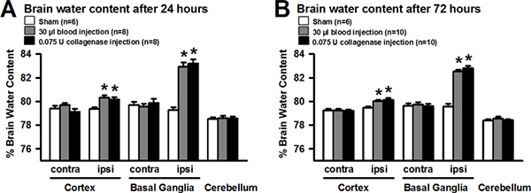 figure-protocol-4 Brain water content comparison graph showing cortex, basal ganglia, cerebellum at 24, 72 hours analysis.