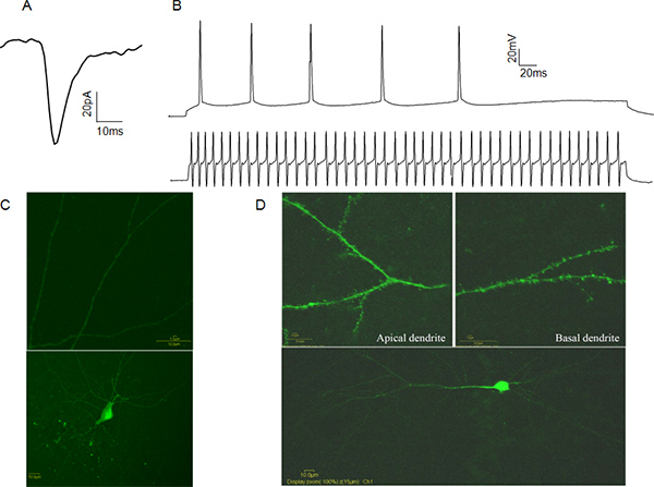 figure-protocol-4 Neuronal signal graphs and fluorescence microscopy of dendrites in electrophysiology study.