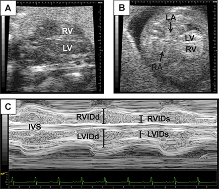 figure-protocol-3 Cardiac ultrasound showing ventricular chambers; echocardiogram with RV, LV, LA, RA annotations.