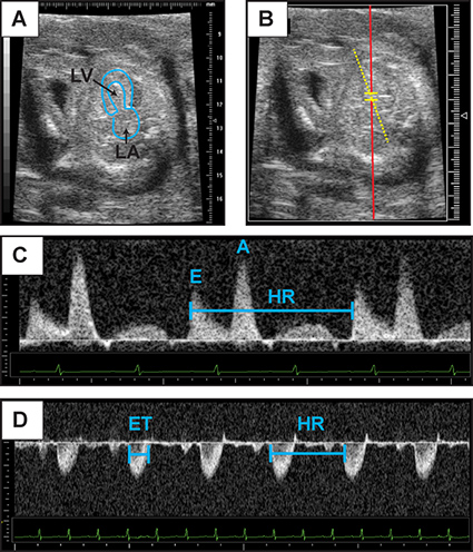 figure-protocol-4 Cardiac ultrasound analysis; echocardiography images and Doppler waveforms showing heart function.