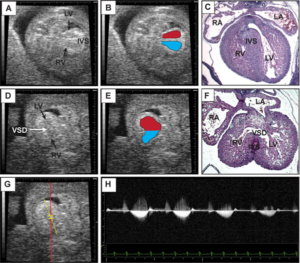 figure-protocol-5 Cardiac ultrasound and histology images showing ventricular septal defect (VSD) and heart anatomy.
