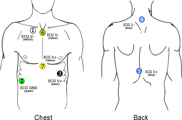 figure-results-1 ICG and ECG electrode placement diagram on human torso, illustrating chest and back positions.