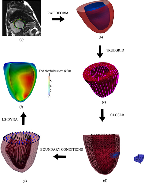figure-results-2 Cardiac modeling workflow: MRI to 3D mesh via Rapidform, TrueGrid, LS-DYNA; stress analysis diagram.