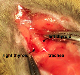 Thyroid anatomy dissection showing left thyroid, right thyroid, and trachea identification.