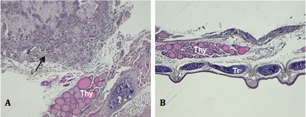 Histology image showing cross-section of thyroid tissue; microscopic examination and cellular detail.