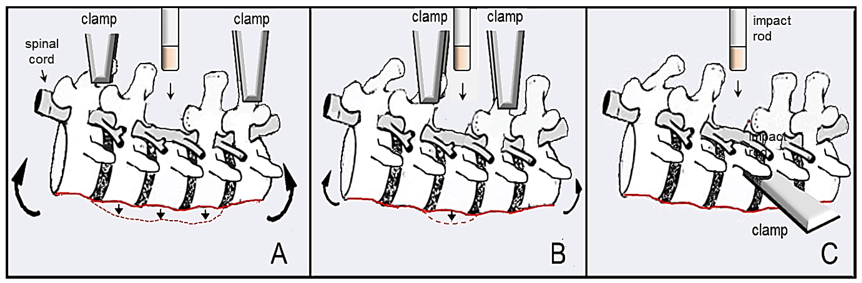 spinal cord injury experiment diagram with clamp and impact rod setup for impact analysis