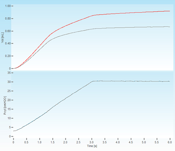 figure-results-5 Volume and pressure vs. time graph, showing fluid dynamics and pressure measurements in experimental setup.