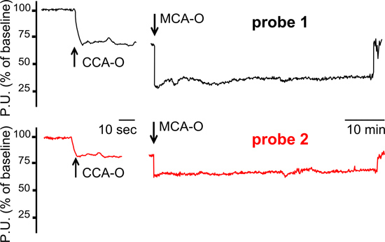 Static equilibrium diagram; probes 1 and 2; vascular flow response CCA-O, MCA-O; time-series graph.