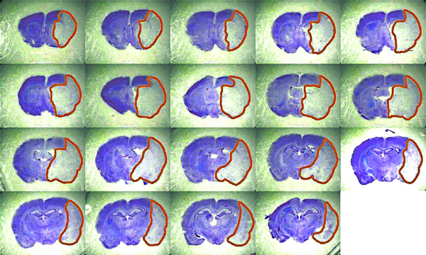 Histology section analysis, brain tissue staining, microscopic imaging, ROI highlighted in serial slices.