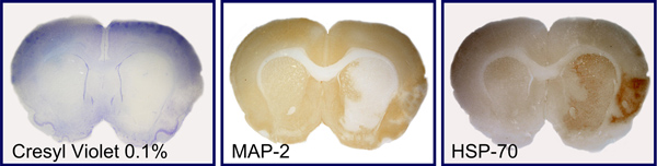 Histological brain slice staining with Cresyl Violet 0.1%, MAP-2, HSP-70; microscopy image.