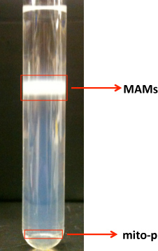 figure-results-1 Cell fractionation results; tube with isolated MAMs and mito-p, experimental separation stages.