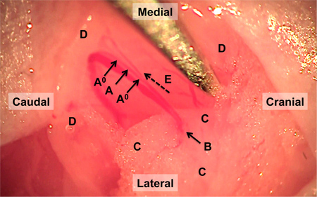 Anatomical dissection diagram showing directional labels and markers on tissue sections.