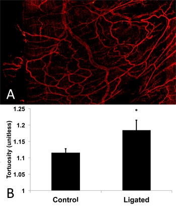 Vascular network diagram and bar chart comparing vessel tortuosity in control vs. ligated samples.
