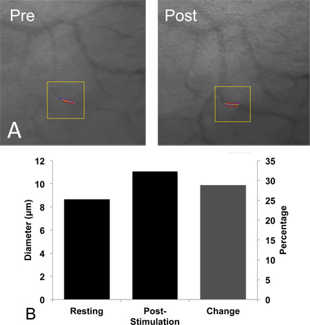Vascular diameter increase; pre- and post-stimulation micrograph, bar chart; capillary dilation study.