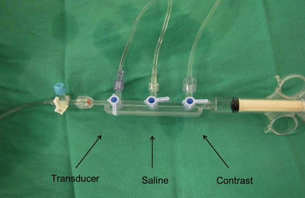 Catheter setup: Saline, contrast, and transducer connections for pressure monitoring procedure.