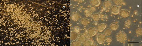 Fungal colony growth comparison, microscope image, biological analysis, cell morphology study.