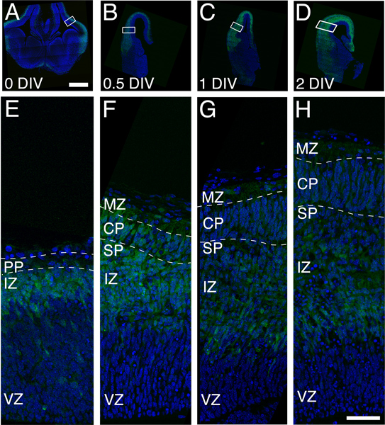figure-results-2 Neuronal development over time; confocal microscope image, brain slice analysis, DIV labeling.