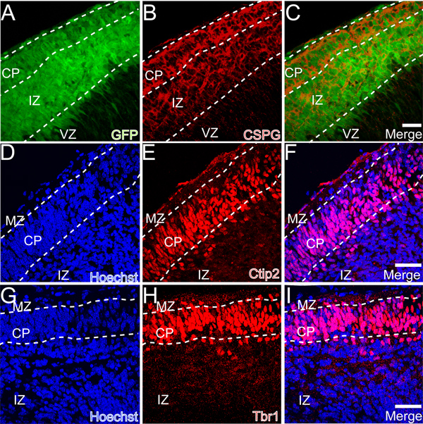 figure-results-3 Fluorescence microscopy of cortical layers labeled with GFP, CSPG, Ctip2, Tbr1, and Hoechst.