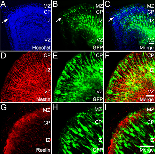 figure-results-4 Neural development microscopy image; Hoechst, GFP staining; diagram; cell distribution analysis.