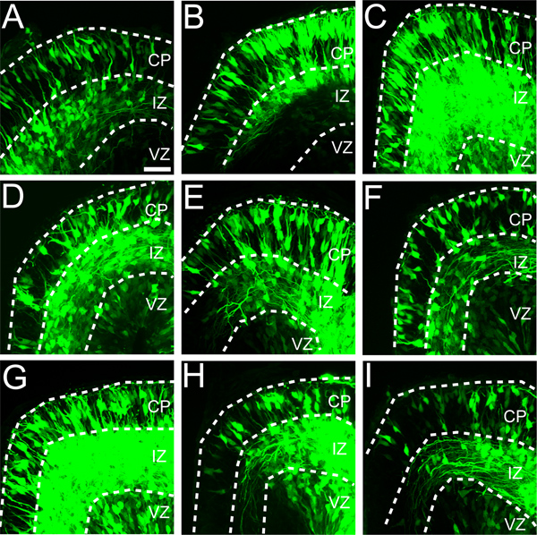figure-results-5 Neural tube development diagram, fluorescence microscopy, CP, IZ, VZ layers, embryonic brain analysis.