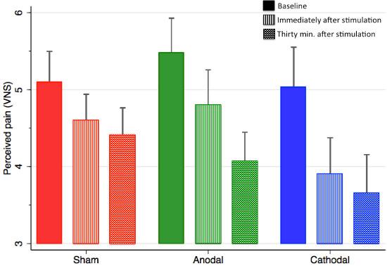 Bar chart of perceived pain levels (VNS) post-stimulation; Sham, Anodal, Cathodal comparison.