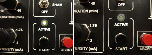 Transcranial stimulation settings panel, showing active and inactive modes; equipment control interface.