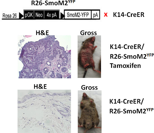 R26-SmoM2<sup>YFP</sup> activation diagram, H&E stain, tumor pathology in K14-CreER model with Tamoxifen.