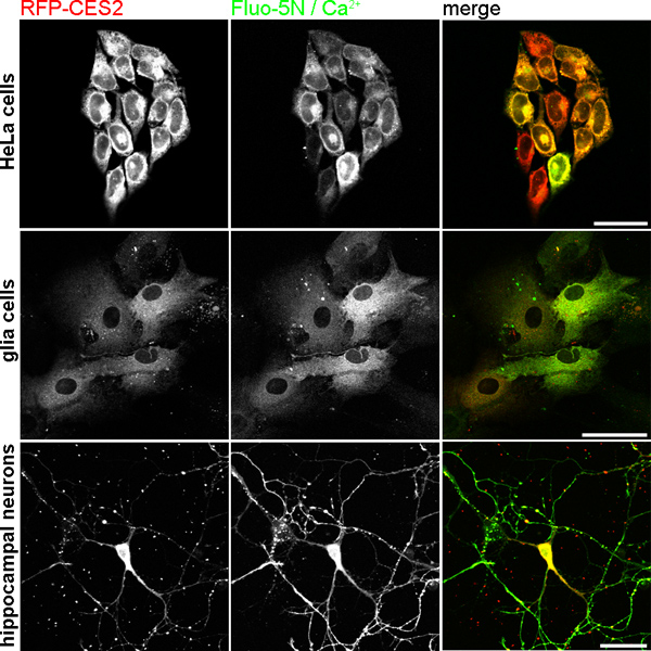figure-results-6 Confocal microscopy imaging of RFP-CES2 and Fluo-5N/Ca²⁺ in HeLa, glia, hippocampal neurons.