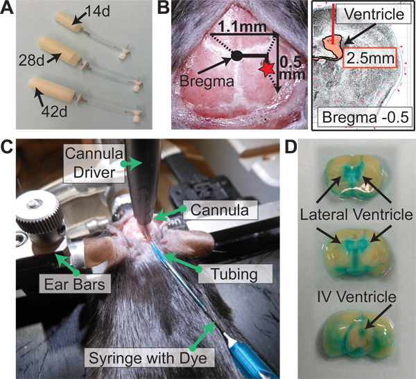 figure-results-3 Stereotaxic rat brain infusion method with cannula, tubing, syringe, and ventricle dye result analysis.