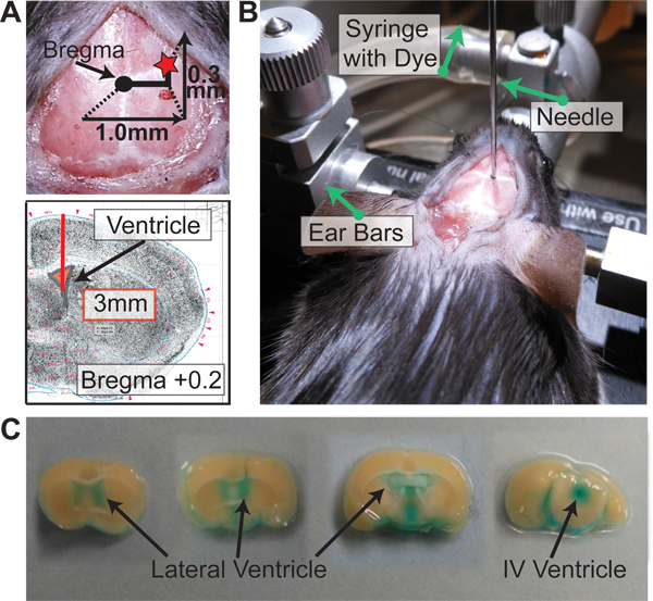 figure-results-4 Brain injection setup; stereotaxic diagram, syringe placement, and ventricles dye results.