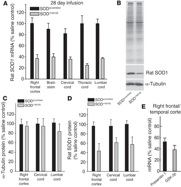 figure-results-5 Rat SOD1 analysis; mRNA, protein levels; Western blot, bar charts; experimental results.