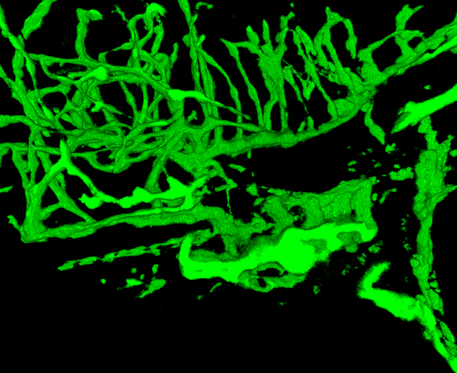 figure-results-5 Fluorescence microscopy image of green neuron network, neural pathways visualization.