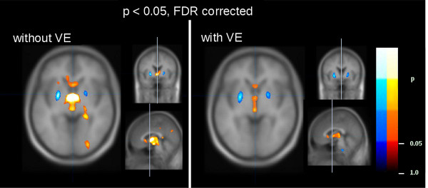 Video: Diffusion Tensor Magnetic Resonance Imaging in the Analysis of ...