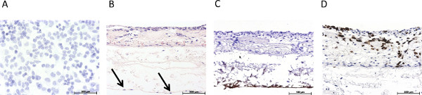 Histological staining comparison; diagram of tissue samples showing cellular structures, scale indicators.