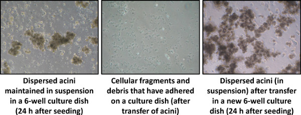 Video: Isolation and Culture of Mouse Primary Pancreatic Acinar Cells