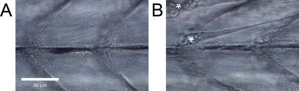 figure-results-5 Microscope image of muscle fibers with annotations; tissue structure analysis.