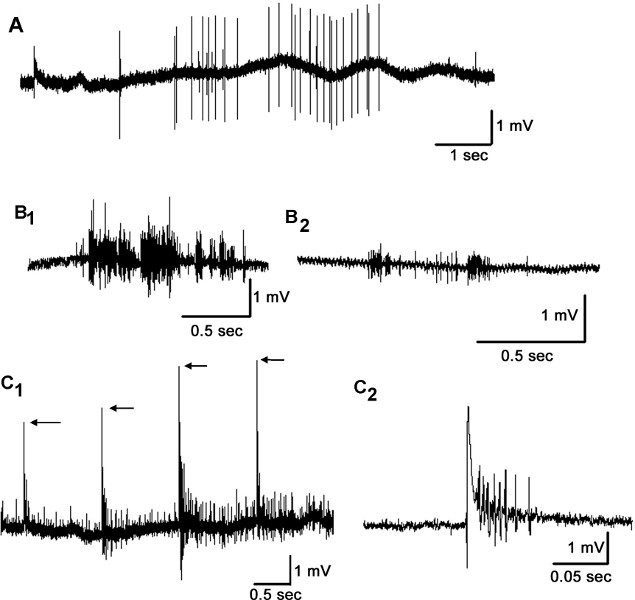 Electrophysiology data, voltage vs time charts showing neuronal activity, measured in millivolts.