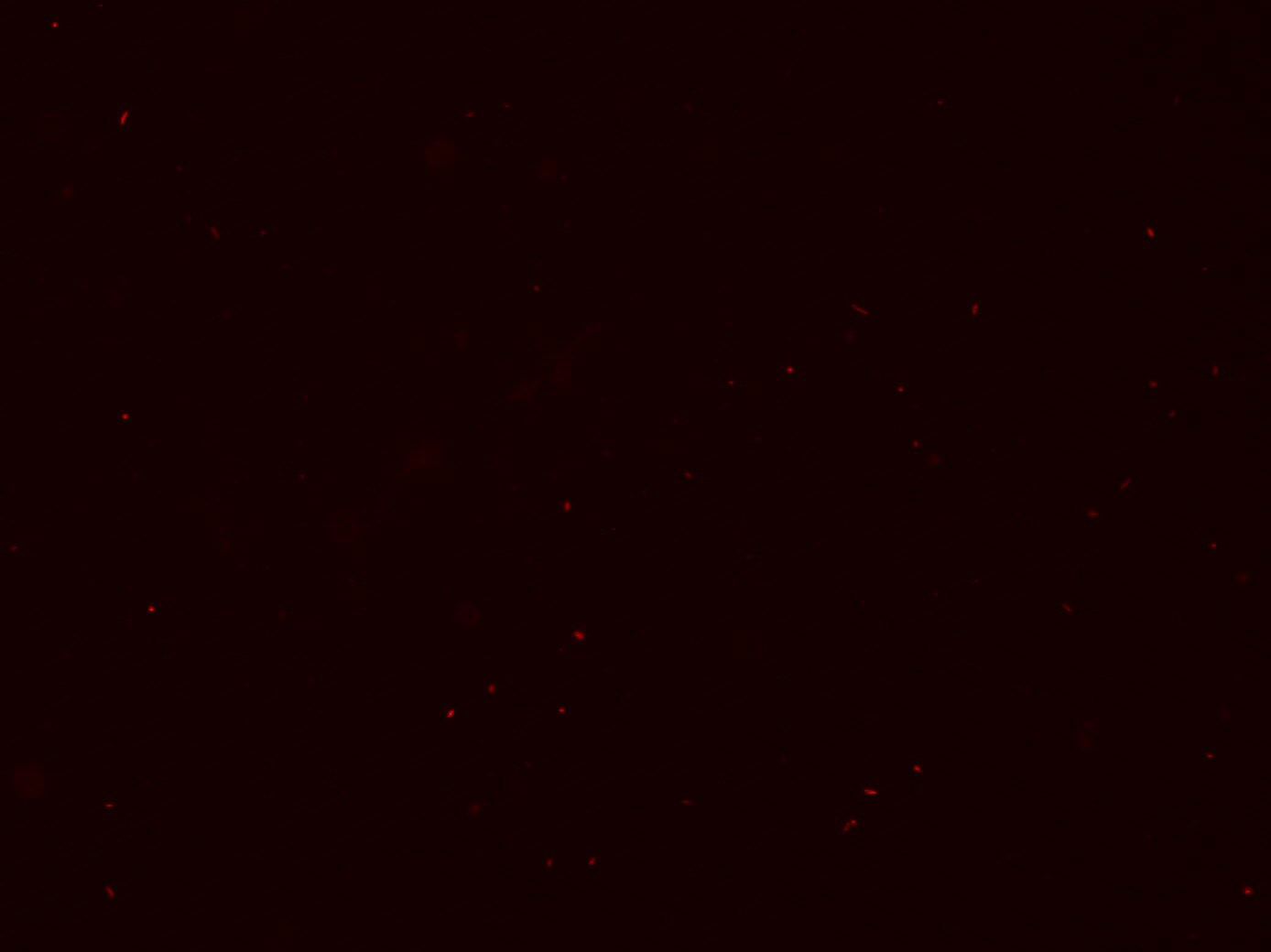 Figure 2. PI staining of M. leprae suspension. Red fluorescence showing ...