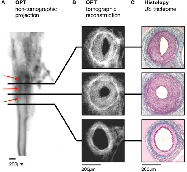 figure-results-3 OPT non-tomographic projection, tomographic reconstruction, histology US trichrome comparison.