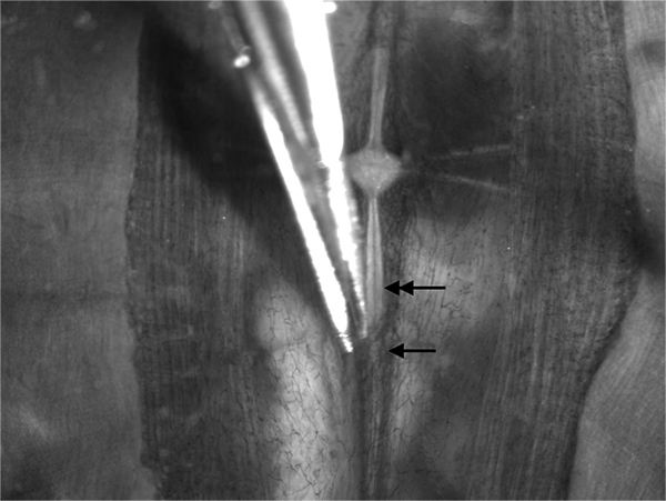 figure-results-2 Esperimento di dissezione che mostra tessuto e pinze, frecce che indicano strutture anatomiche specifiche.