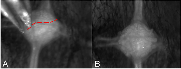 figure-results-5 Processo di assotomia neuronale, immagine al microscopio che mostra il taglio assonale e la successiva risposta del corpo cellulare.