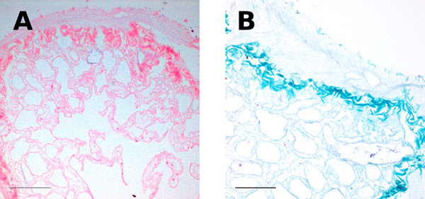 figure-results-3 Histology images comparing tissue sections stained with two different dyes; microscopy results.